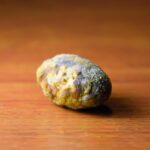 Gallstone Surgery in Dubai