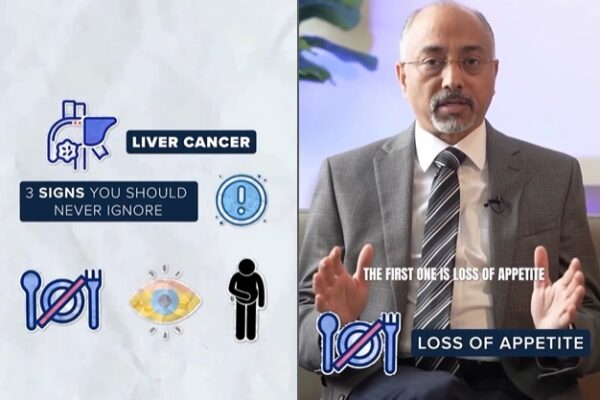 Liver Cancer Surgery in Dubai