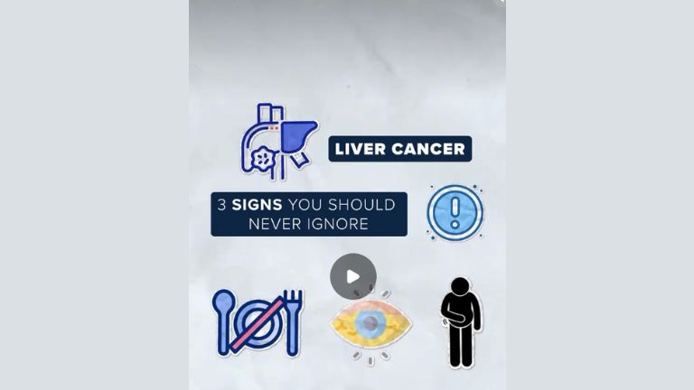 If you drink alcohol - this message is for you! 🫵 Alcohol can cause irreversible injury to your liver, and it is important to know that it isn’t just about how much