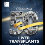 50 LIVER TRANSPLANT SURGERIES