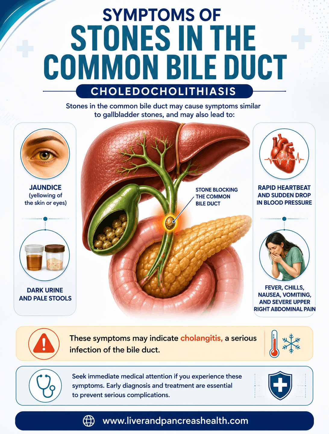 Common Bile Duct Stones Treatment in Dubai
